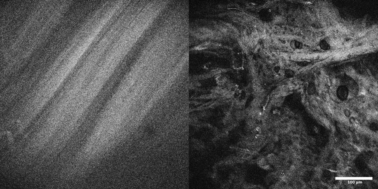 7. 自体荧光成像.jpg 7. 自体荧光成像.jpg