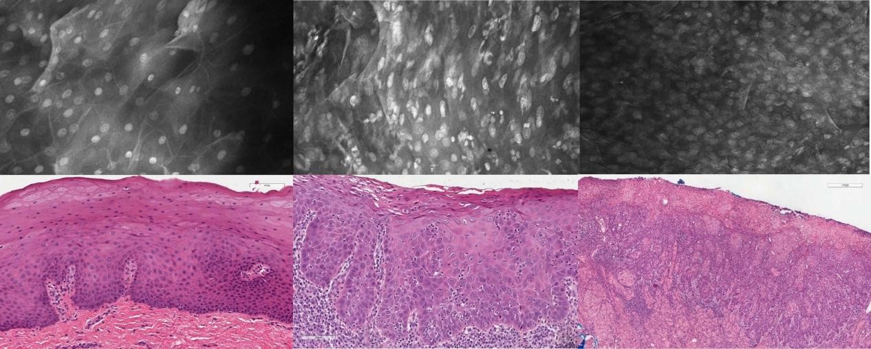 1. 口腔癌.jpg 1. 口腔癌.jpg