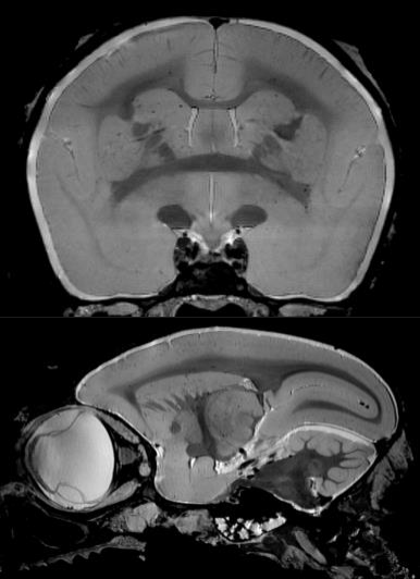 猴脑成像.png 猴脑成像.png