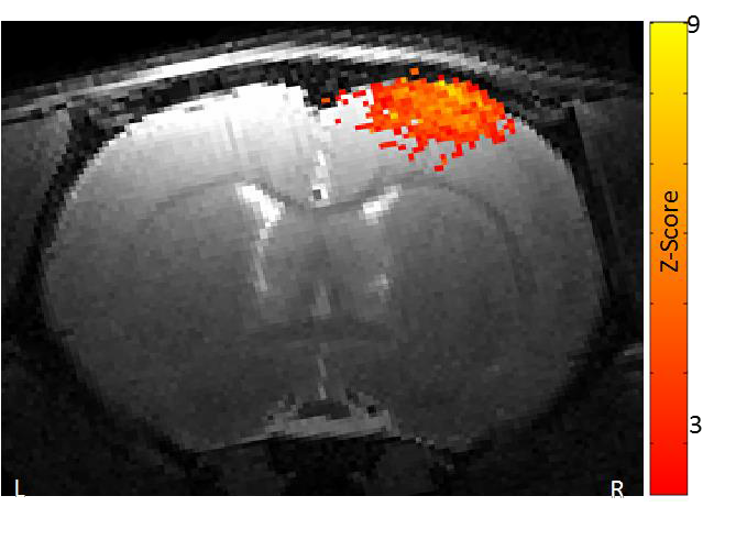 功能磁共振成像.png 功能磁共振成像.png