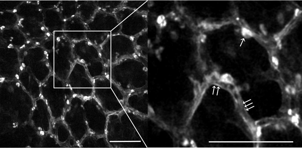 9. 肺内皮三重标记.jpg 9. 肺内皮三重标记.jpg