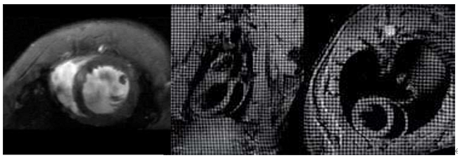 心脏成像 - 小.png 心脏成像 - 小.png