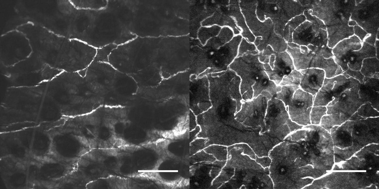 6. 肿瘤血管生成.jpg 6. 肿瘤血管生成.jpg