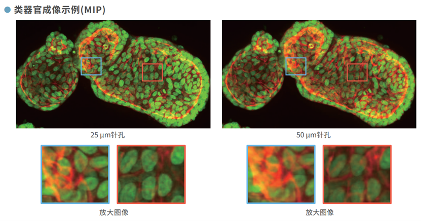类器官成像.png 类器官成像.png