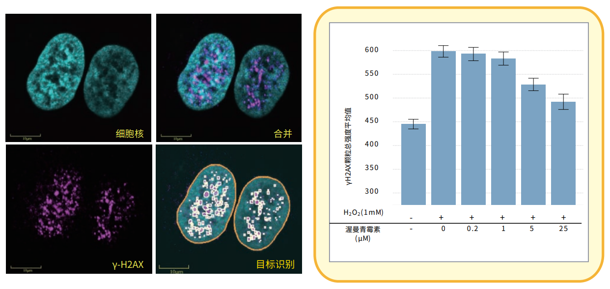 应用3 y-H2AX焦点形成.png 应用3 y-H2AX焦点形成.png