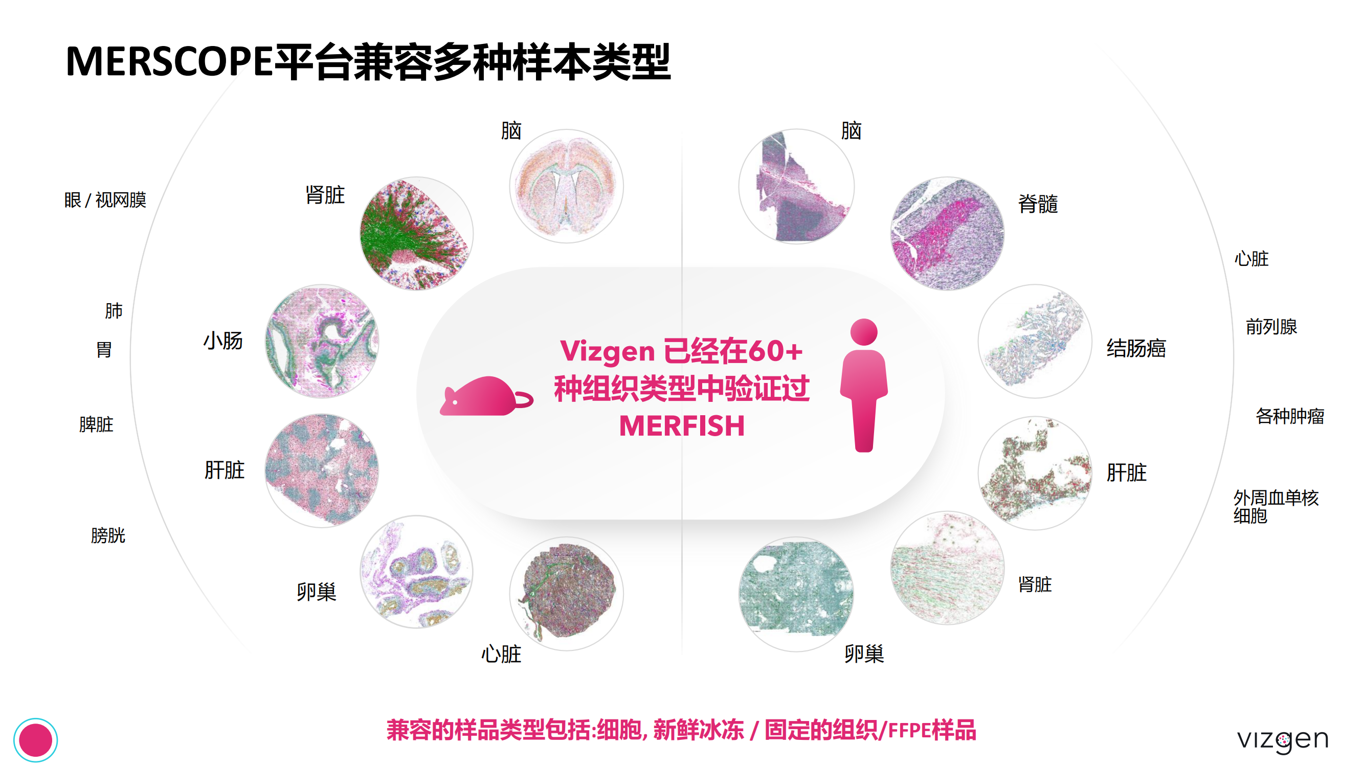 Vizgen intro deck(森西赛智) 20240314(1)_26.png Vizgen intro deck(森西赛智) 20240314(1)_26.png