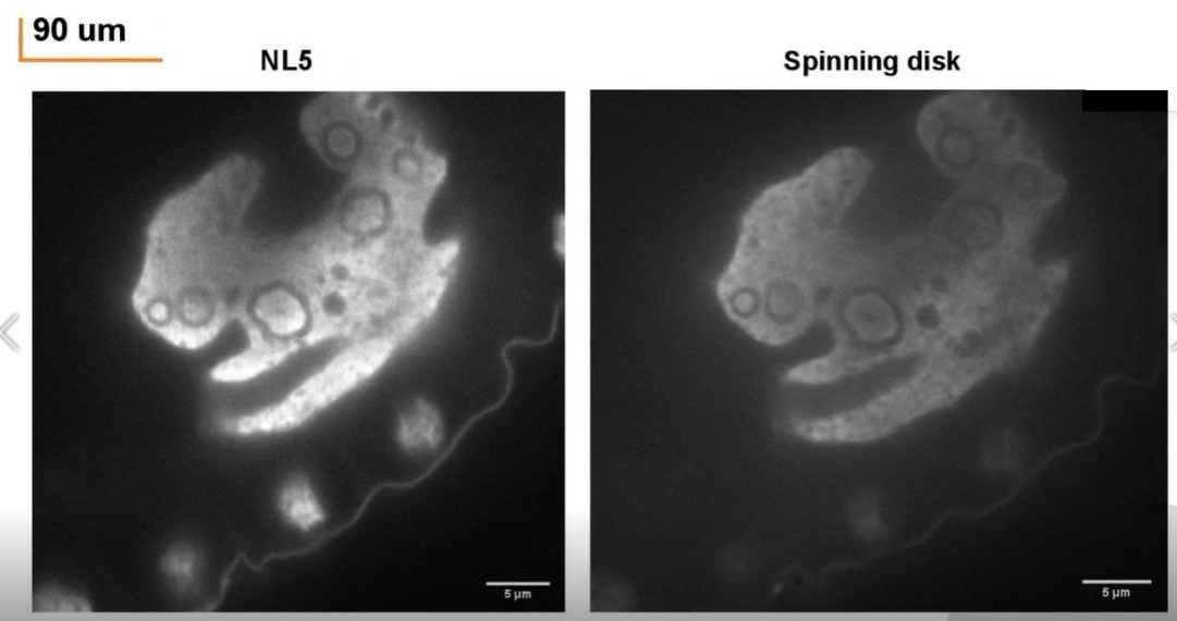 深度3D成像-90um.jpg 深度3D成像-90um.jpg